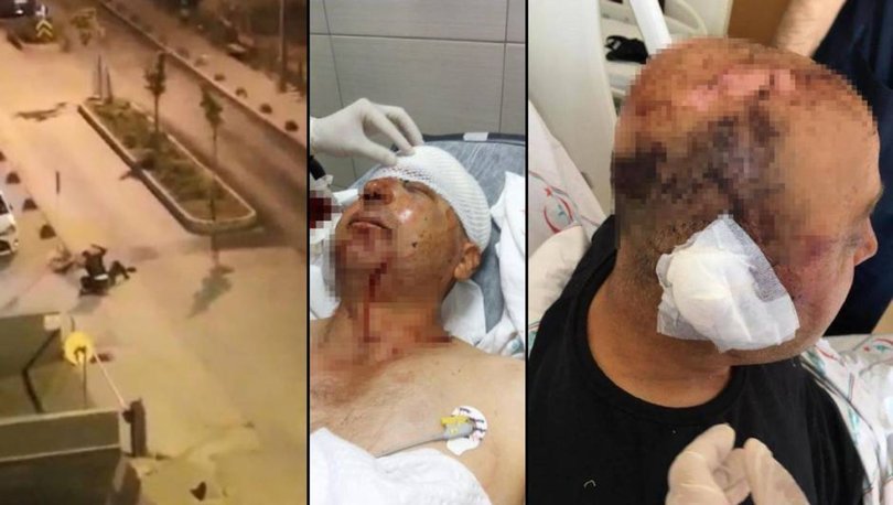 Dehşet anları! Telsizle polisin kafasını parçaladı, 1.5 yıldır yargılanamıyor