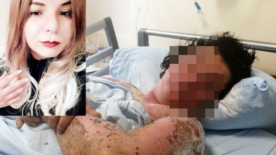 Yanlış antibiyotik kullanımı genç kızın hayatını kararttı