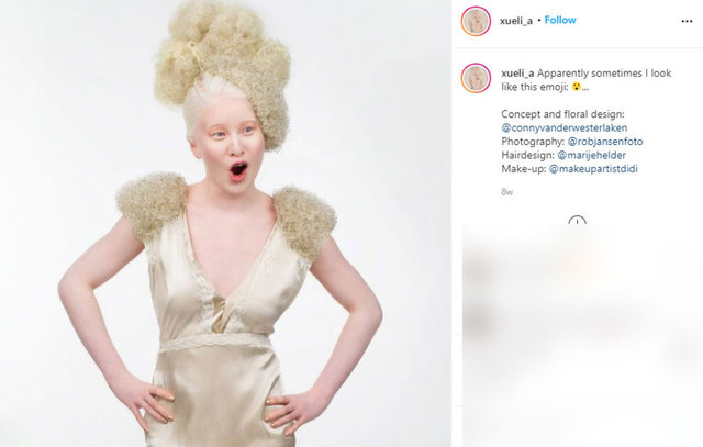 Bebekken terk edilen Çinli albino model Xueli Abbing ilham veriyor…